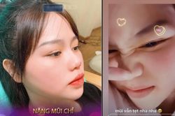 Bị đồn nâng mũi, sửa mặt, bạn gái Quang Hải lập tức lên tiếng