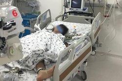 Nhổ răng sâu, răng văng vào phế quản phải đi cấp cứu