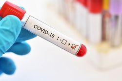 Chinh thức thông báo về 14 ca mới mắc Covid-19