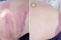 Xác minh vụ người đàn ông đi lang thang, xin ăn trên đường nghi bị đánh bầm dập
