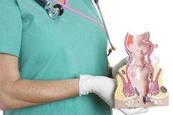 Xử lý tại chỗ bệnh trĩ bằng thảo dược theo phương pháp YHCT