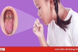 Tăng cường phòng, chống bệnh bạch hầu