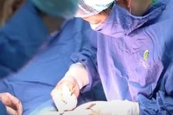 Nhiều lần mang thai vẫn chưa được làm mẹ, biết được nguyên nhân đã vô cùng sửng sốt