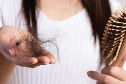 Chị em đừng dại mà động vào các loại thực phẩm này nhiều nếu không chẳng mấy chốc mà hói đầu