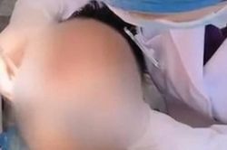 Chảy máu liên tiếp 10 ngày sau khi nhổ răng khôn, chàng trai 26 tuổi tử vong do nhiễm trùng máu