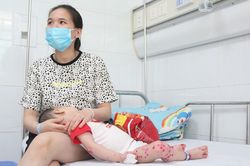 Số trẻ mắc tay chân miệng tăng gấp 5-6 lần: Chuyên gia chỉ rõ dấu hiệu bệnh
