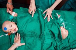 Kế hoạch của 100 y bác sĩ trong 12 tiếng mổ tách song sinh dính liền