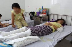 Chồng đổ dầu đốt nệm vợ con đang ngủ khiến 3 người bị bỏng
