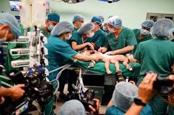 Tách rời thành công hai bé dính nhau