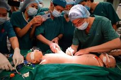 Đang phẫu thuật tách cặp song sinh dính liền: Sinh hiệu hai bé ổn định