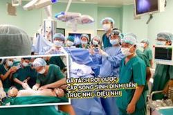 Đã tách rời được cặp song sinh dính liền Trúc - Diệu