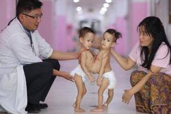 Kỳ diệu những ca phẫu thuật tách rời thành công cặp song sinh dính liền trên thế giới