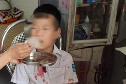 Học sinh lớp 1 bị hành hung dã man ở Hòa Bình: Đã khởi tố vụ án