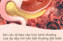 Hai căn bệnh cực kỳ phổ biến và rất dễ phát triển thành ung thư, bạn cần ngăn chặn ngay từ bây giờ
