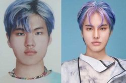 Rapper Hàn đăng ảnh băng bó mặt, thừa nhận 'dao kéo' vì bị miệt thị