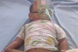 Bé 16 tháng tuổi nhập viện cấp cứu vì uống nhầm dầu hỏa trong chai nước giải khát