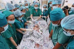 Cặp song sinh Trúc Nhi - Diệu Nhi đã tỉnh, sức khỏe ổn định