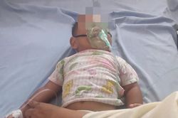 Cứu bé trai 16 tháng tuổi uống nhầm dầu hỏa bỏ trong vỏ chai nước khoáng