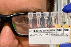 Xét nghiệm phát hiện nhanh COVID-19 bằng mẫu máu chỉ trong khoảng 20 phút