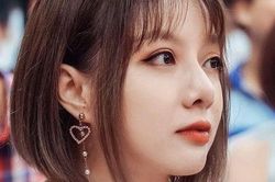 Vẻ ngoài trẻ hơn tuổi của nữ MC tuổi Dần có nguy cơ bị mù
