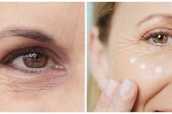 Làm gì để hạn chế lão hóa mắt?