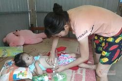 Vết sẹo dài trên ngực cùng dị tật bẩm sinh đẩy bé gái 3 tuổi vào cảnh khốn cùng