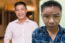 'Hốt hoảng' trước gương mặt sưng vù của NSND Công Lý