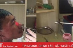 Xem bác sỹ ở Hà Tĩnh gắp con đỉa trong hốc mũi người đàn ông đến từ Quảng Bình