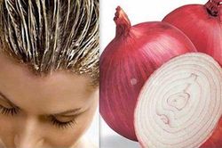 Mẹo hay: 'Tạm biệt' tóc rụng, hói đầu chỉ bằng 1 củ hành tây