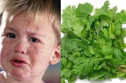 Rau mùi: 'Thần dược' chữa bệnh thủy đậu mà ai ai cũng cần 'giắt lưng'