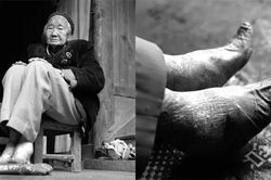 Ký ức bó chân kinh hoàng qua lời kể của cụ bà trăm tuổi có đôi chân 8cm
