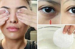 Nếu bạn thường khuyên thức khuya sau 23h, đây là 10 cách giúp giấu tình trạng mất ngủ trên mặt