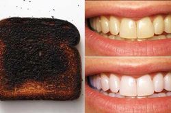 Nướng cháy bánh mì rồi chà lên răng 2 phút, răng trắng, cao răng bong ra từng mảng