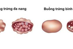 Tác hại do dậy thì sớm ở bé gái