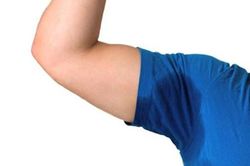 Nách nhiều mồ hôi, phải làm gì?