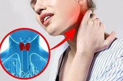 Thu hồi thuốc trị rối loạn tuyến giáp