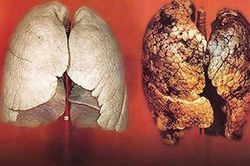 Đây chính là loại quả ăn vào lọc sạch phổi cho người hút thuốc lá, ai cũng nên biết để tự cứu mình