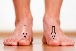 Bàn chân xuất hiện cùng lúc 3 dấu hiệu này: Cảnh báo thận đang 'kêu cứu' gấp, hãy đi kiểm tra ngay