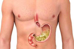 5 loại thực phẩm 'cấm' ăn khi bụng đói kẻo tự tay 'phá nát' dạ dày