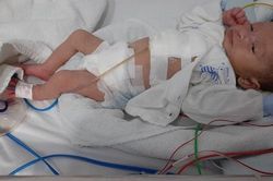 Xót xa cảnh người phụ nữ góa phụ mong có tiền để phẫu thuật tim bẩm sinh cho con