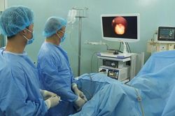 Dùng laser tán vỡ sỏi to trong bàng quang 22 năm