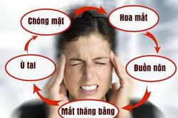 Phân biệt rối loạn tiền đình và thiếu máu não