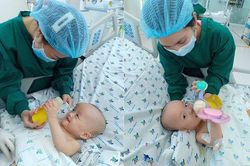 Sau 20 ngày mổ tách, hai bé song Nhi đã tự thở