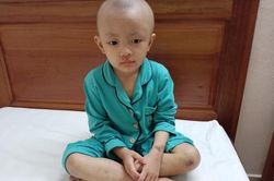 'Mẹ ơi, các bạn gọi con là thằng đầu trọc'