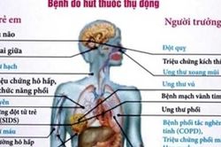 Thuốc lá và khói thuốc lá - 'kẻ giết người' thầm lặng