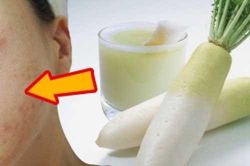 Củ cải không chỉ để nấu các món ngon mà còn có tác dụng chữa bệnh thần kỳ, có thể bạn chưa biết