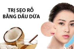 Cách trị sẹo rỗ trên mặt lâu năm tại nhà hiệu quả nhanh nhất