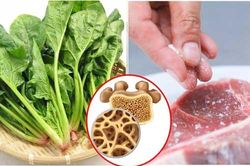 Những loại thực phẩm dễ phá hủy xương khớp, số 1 nhiều người mắc phải mà không hề biết