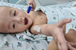 Trúc Nhi - Diệu Nhi sắp được tập đi sau ca mổ tách rời