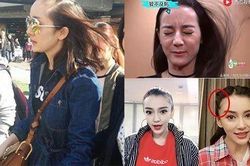 Dù xinh đẹp nhưng loạt mỹ nhân Hoa ngữ đều phải đối diện với nỗi lo này